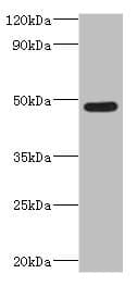 Polyclonal Rabbit anti-Human IFT57 / HIPPI Antibody (aa170-429, IHC, WB)