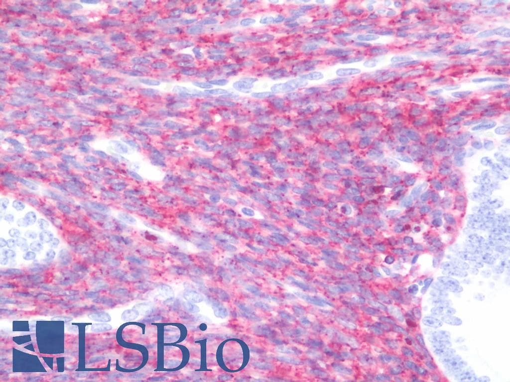 IHC-plus™ GJA1 / CX43 / Connexin 43 Antibody (C-Terminus)