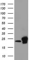 SSSCA1 / p27 Antibody (clone OTI2F5)
