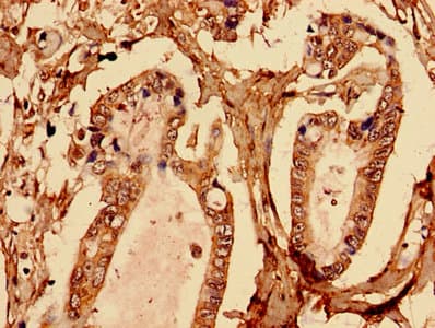 BGN / Biglycan Antibody