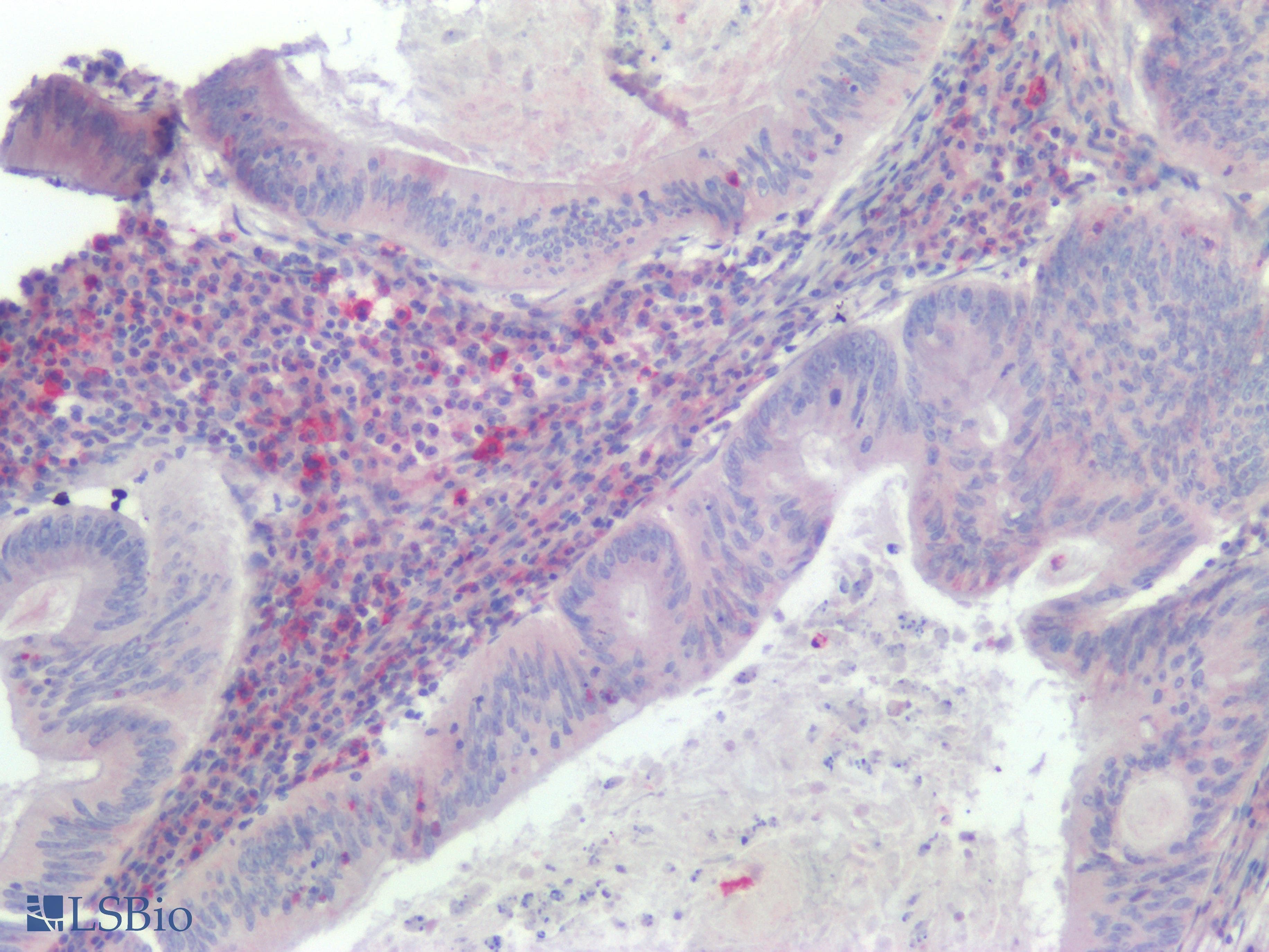 PathPlus™ Polyclonal Rabbit anti-Human KRAS Antibody (IHC)