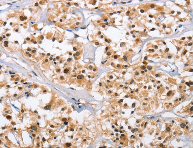 Polyclonal Rabbit anti-Human NCAPD3 / HCAP-D3 Antibody (IHC)