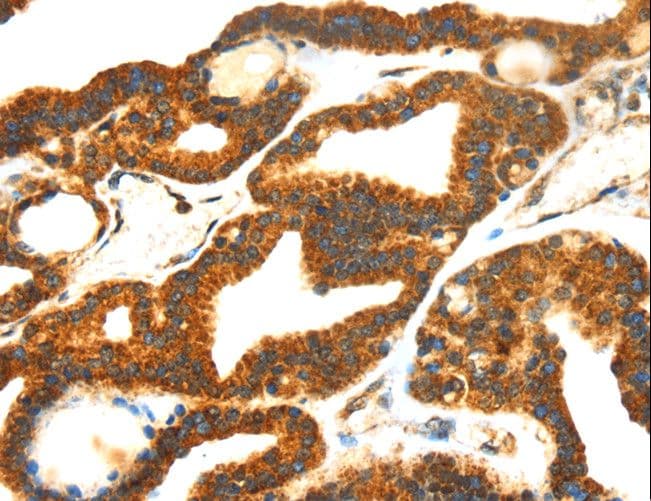 Polyclonal Rabbit anti-Human SMYD4 Antibody (IHC)