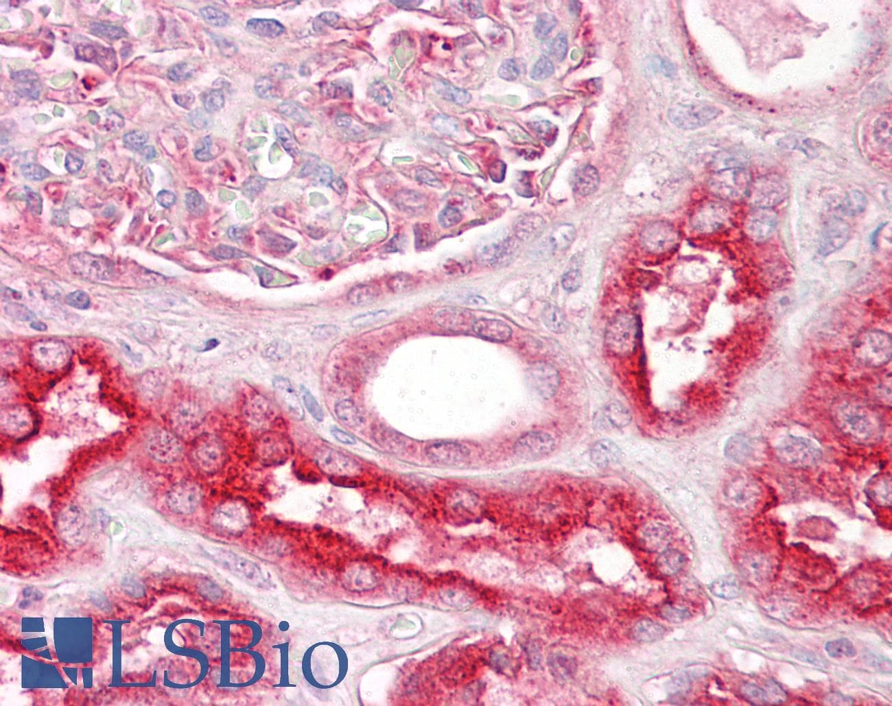 IHC-plus™ Polyclonal Goat anti-Human VPS11 Antibody (aa350-362, IHC)