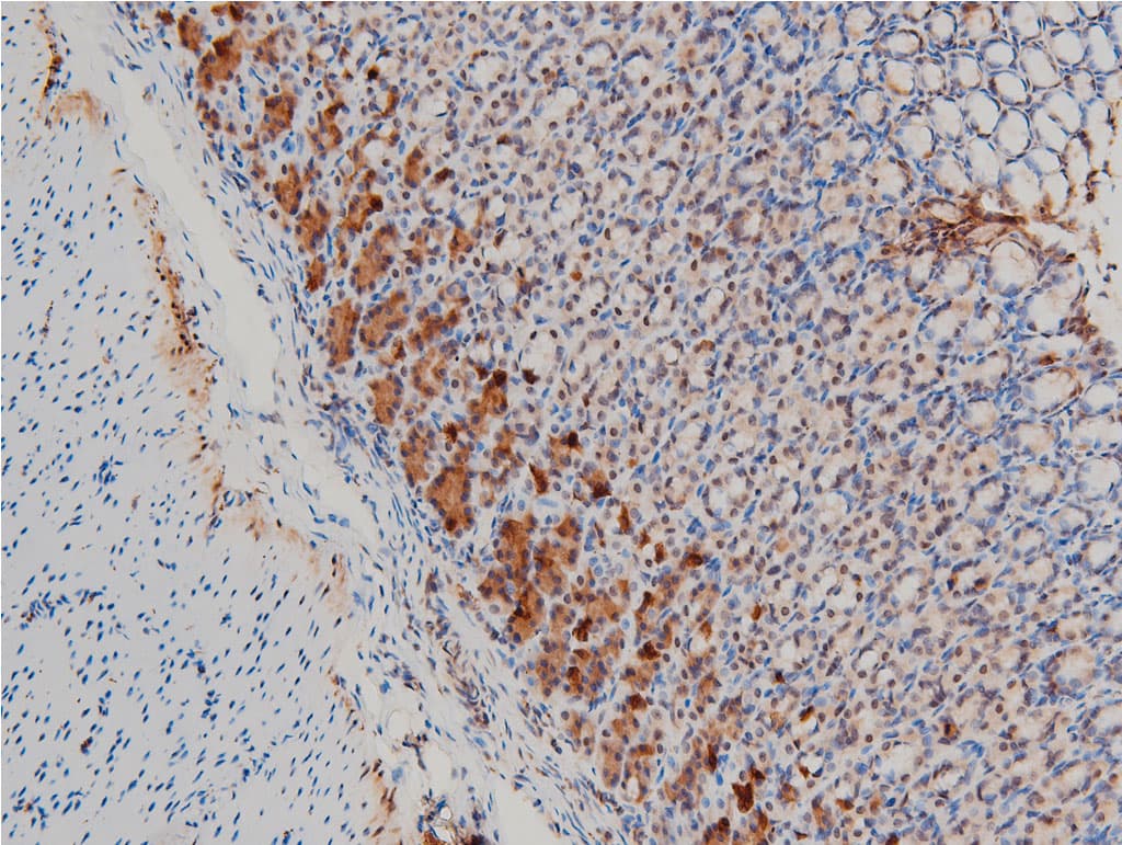 LIMK1 / LIMK Antibody (phospho-Thr508)
