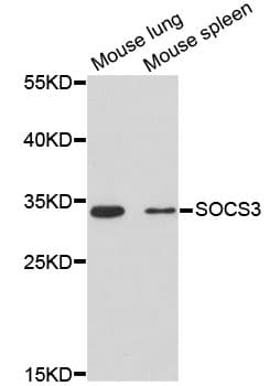 SOCS3 Antibody