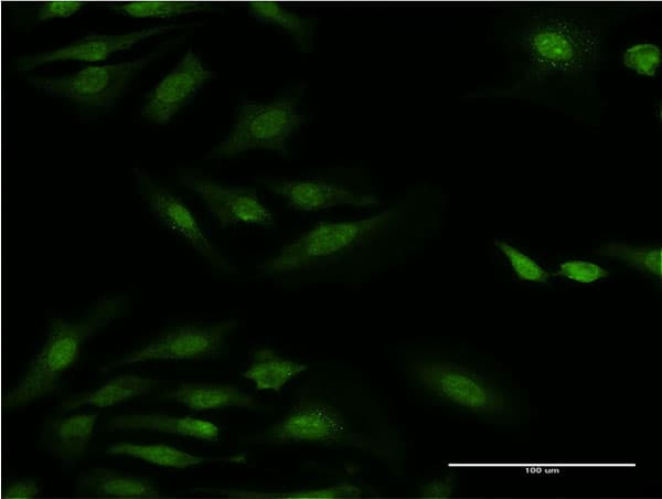 RPS29 / Ribosomal Protein S29 Antibody (clone 3G9)