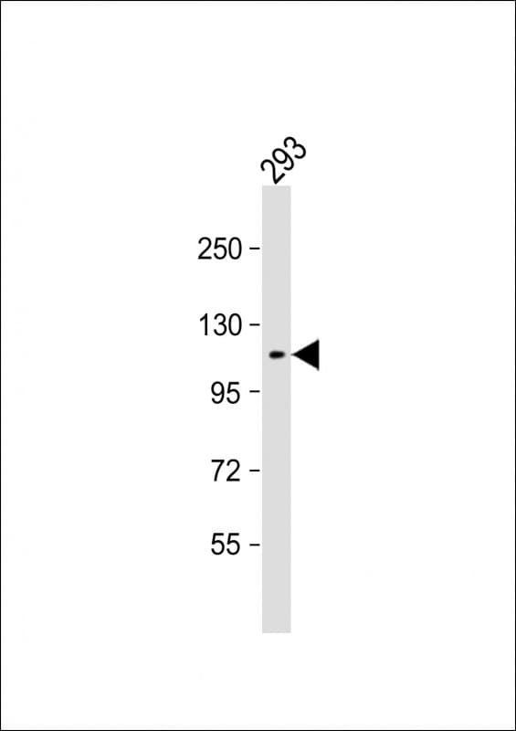 c-Kit / CD117 Antibody (Tyr721)