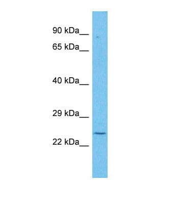 TMEM151B Antibody (aa38-87)
