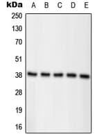 Polyclonal Rabbit anti-Human NPM1 / NPM / Nucleophosmin Antibody (phospho-Thr234, WB)