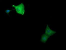 Monoclonal Mouse anti-Human MAP2K1 / MKK1 / MEK1 Antibody (clone OTI1A9, IHC, IF, WB)