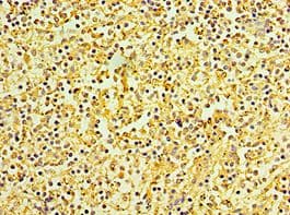 KCTD15 Antibody (aa1-234)