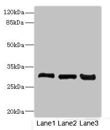 Polyclonal Rabbit anti-Human KHK / Ketohexokinase Antibody (IHC, WB)