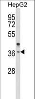 OR2H3 / OR2H2 Antibody (aa276-302)