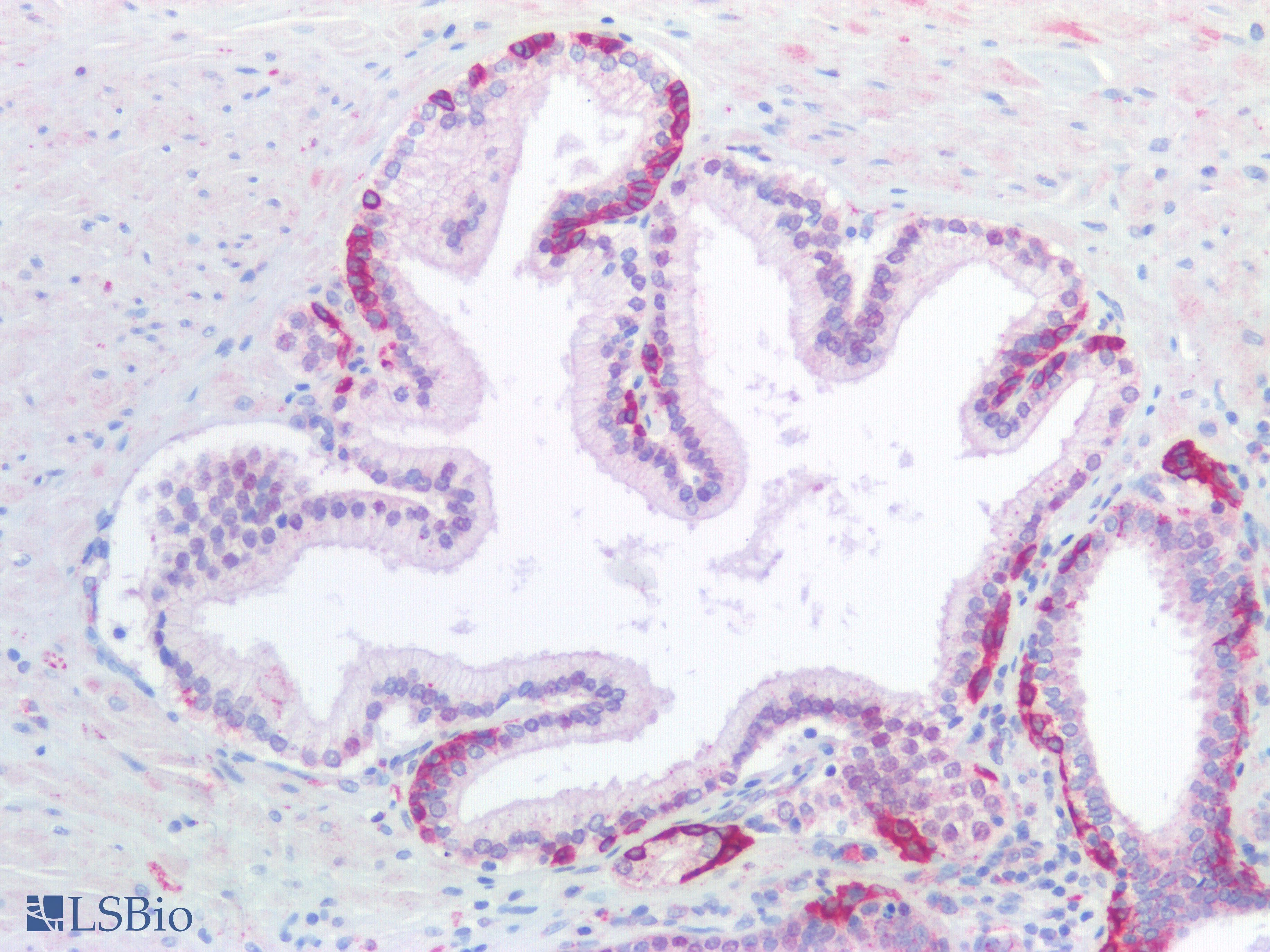 PathPlus™ KRT5 / CK5 / Cytokeratin 5 Antibody (C-Terminus)