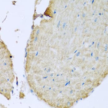 TMEM173 / STING Antibody
