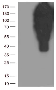 CDH1 / E Cadherin Antibody (clone UMAB184)