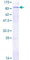 Human MOX / MOXD1 Protein (Recombinant GST)