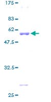 Human STX8 / Syntaxin 8 Protein (Recombinant GST)