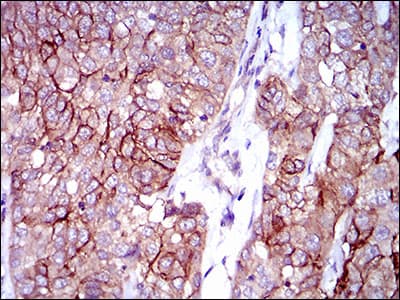 ALCAM / CD166 Antibody (aa48-216, clone 4H9A5)