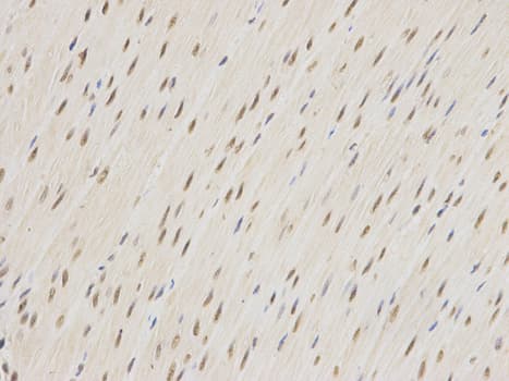 Polyclonal Rabbit anti-Human ZEB1 / AREB6 Antibody (IHC, IF, WB)