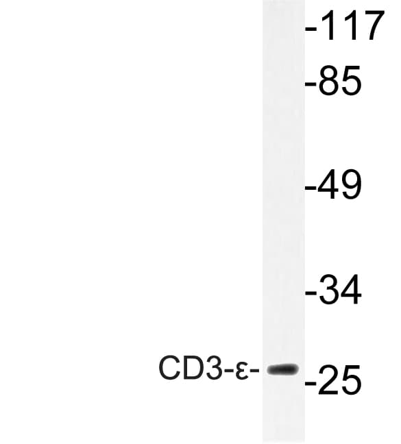 CD3E Antibody (Asp71)
