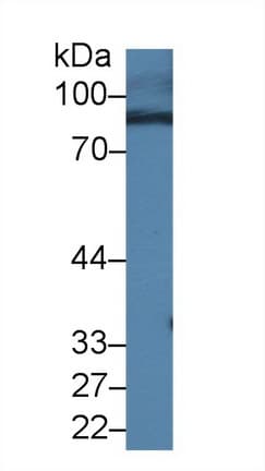 RIP1 / RALBP1 Antibody (aa192-380)