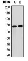 Polyclonal Rabbit anti-Human FOXO1 / FKHR Antibody (Internal, IHC, IF, WB)
