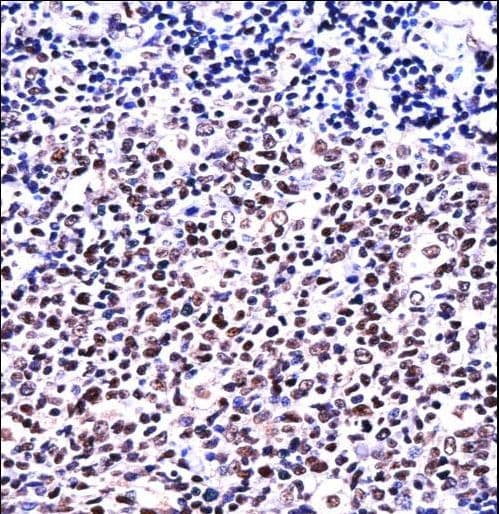 NFATC1 / NFAT2 Antibody (aa898-927)