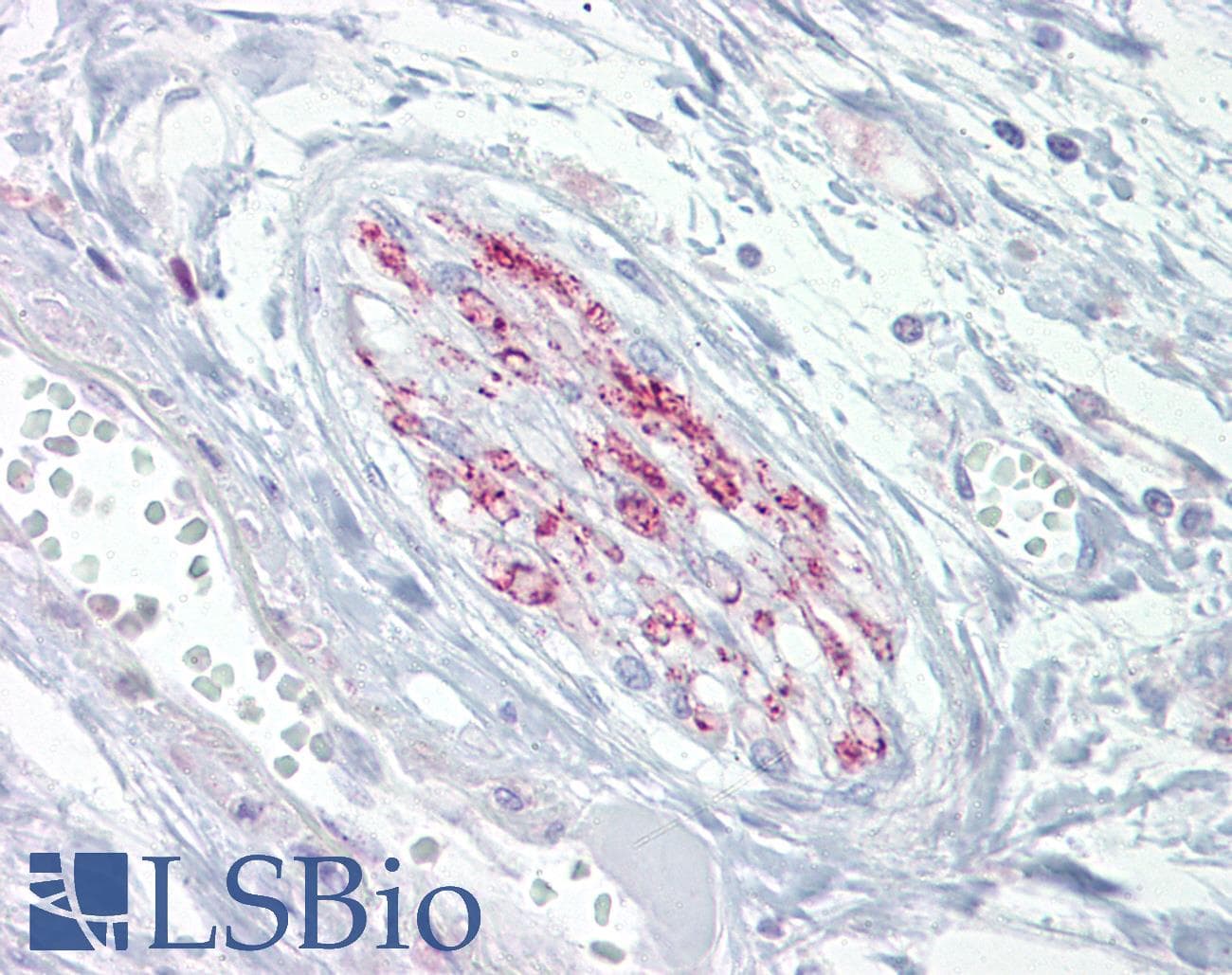 IHC-plus™ CACNA2D1 Antibody