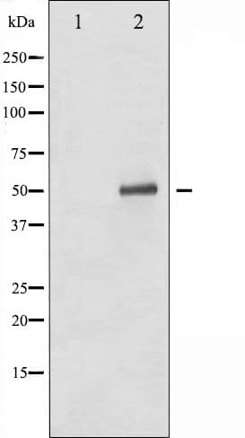 TP53 / p53 Antibody (phospho-Ser392)