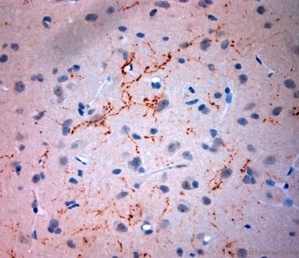 Polyclonal Rabbit anti-Rat SYNPO / Synaptopodin Antibody (aa890-930, IHC)