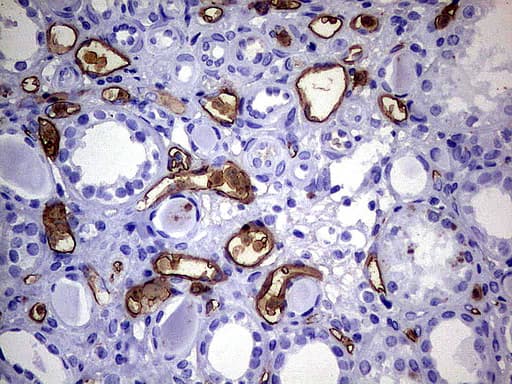 S100A9 / MRP14 Antibody (clone UMAB174, Carrier-free)