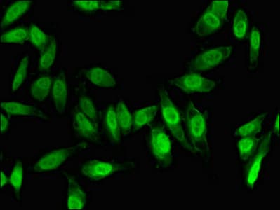 Polyclonal Rabbit anti-Human FOXC1 Antibody (IF, WB)
