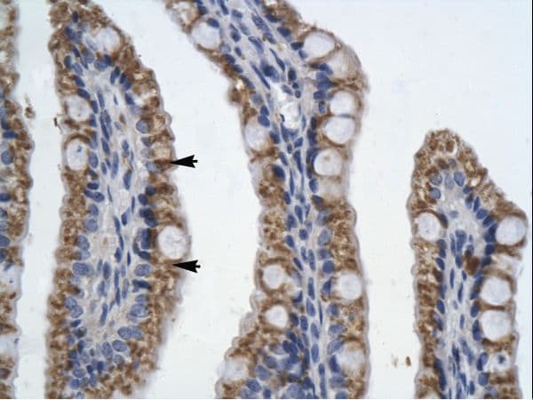 PITX2 / RGS Antibody (aa20-69)