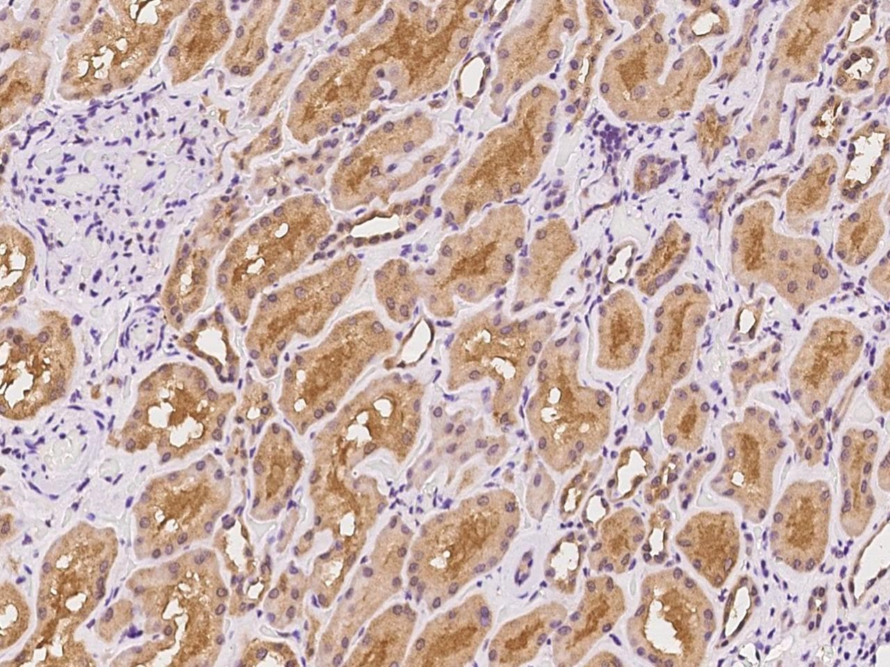 Polyclonal Rabbit anti-Human RPGR Antibody (IHC)
