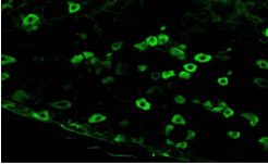 Monoclonal Mouse anti-Rat SCN10A / Nav1.8 Antibody (clone S134-12, IHC, IF, WB)