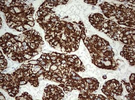 Monoclonal Mouse anti-Human OTC Antibody (clone OTI4G8, aa33-354, IHC, WB)