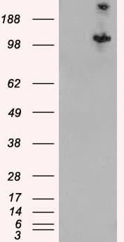 IHC-plus™ Hamartin / TSC1 Antibody (aa1150-1163)