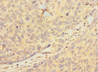 HIST1H2BD Antibody