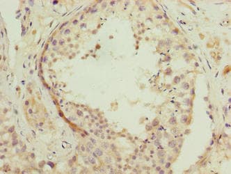 NSUN7 Antibody