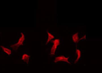 PPP4R1L Antibody