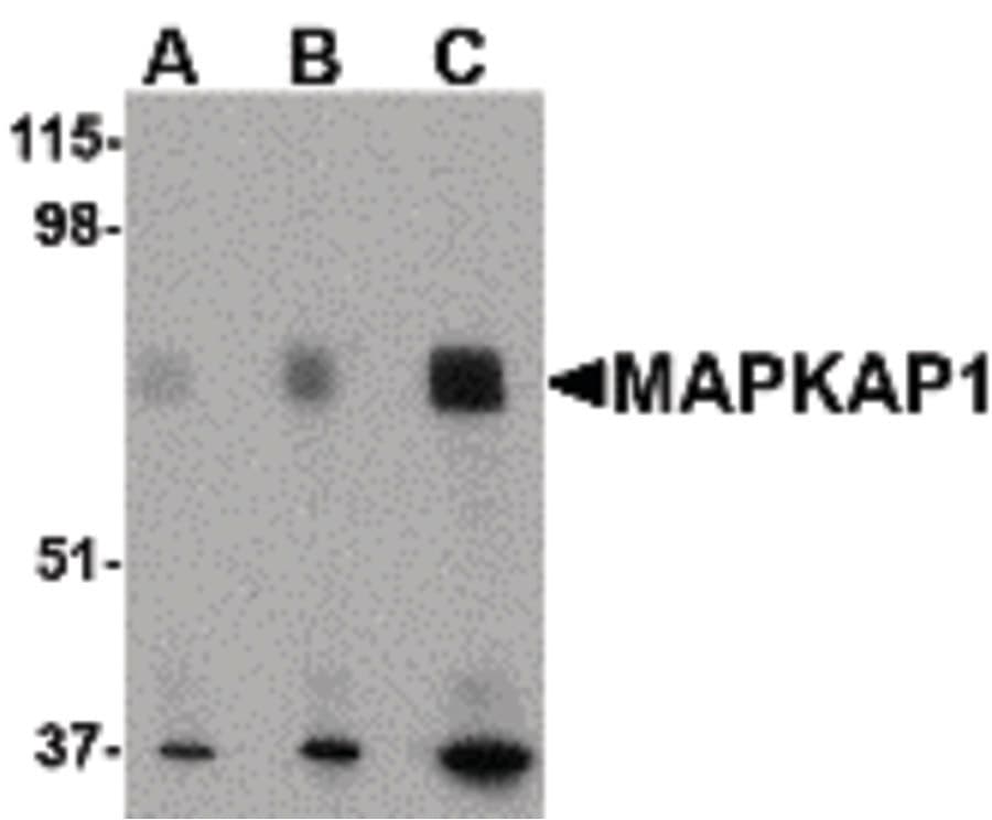 IHC-plus™ MAPKAP1 / MIP1 Antibody