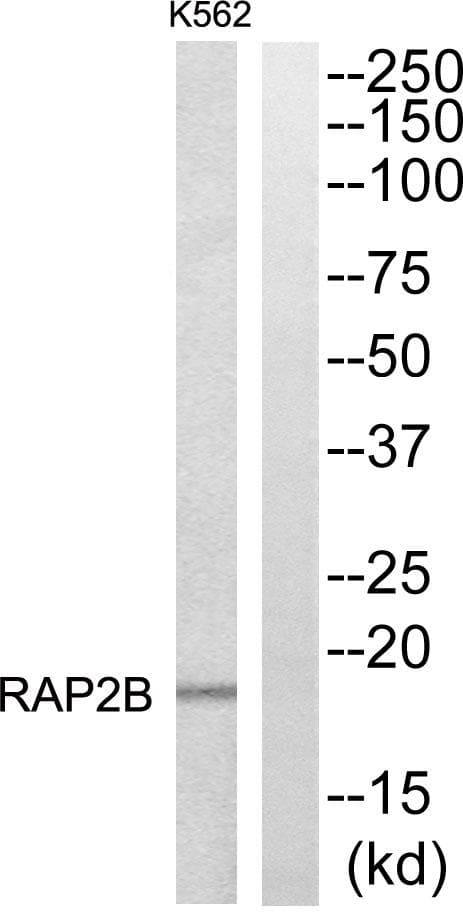Polyclonal Rabbit anti-Human RAP2B Antibody (WB)