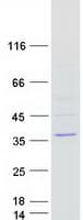 Human LIX1 Protein (Recombinant Myc-DDK (Flag))