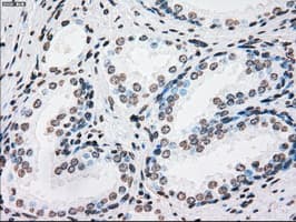 PLK1 / PLK-1 Antibody (clone OTI1D4)