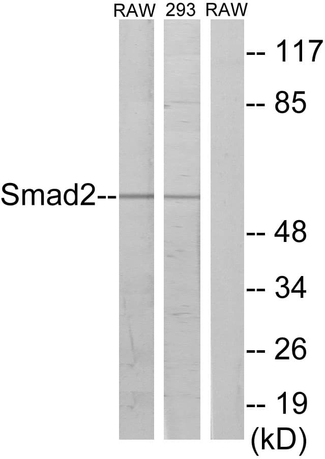 SMAD2 Antibody (aa186-235)