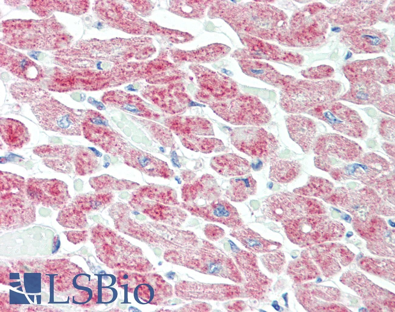 IHC-plus™ YTHDF1 Antibody (aa1-50)
