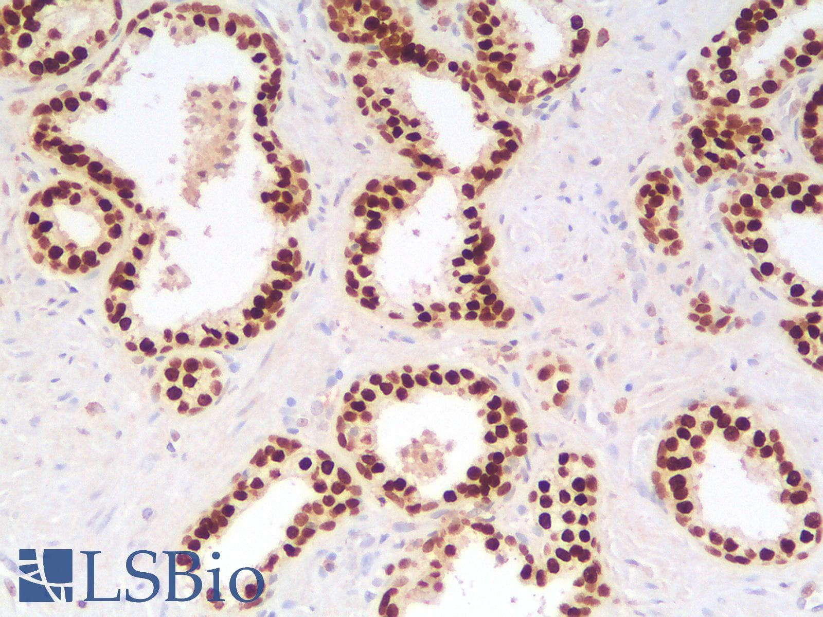 PathPlus™ FOXA1 Antibody (aa372-472, clone rFOXA1/1515)