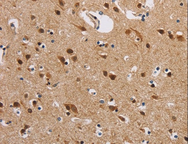 IHC-plus™ Polyclonal Rabbit anti-Human IL19 Antibody (aa39-52, IHC, WB)